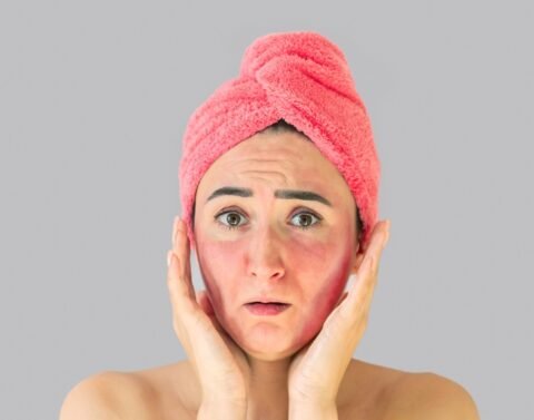 Skin Rashes and Swelling After Eating Certain Foods