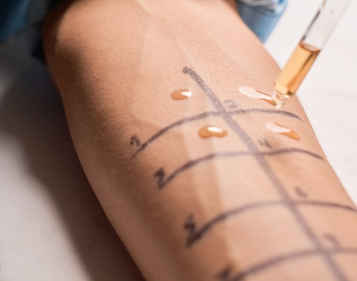 Affordable Allergy Testing Services Near Me in Richmond, TX: Find Reliable Allergy Services