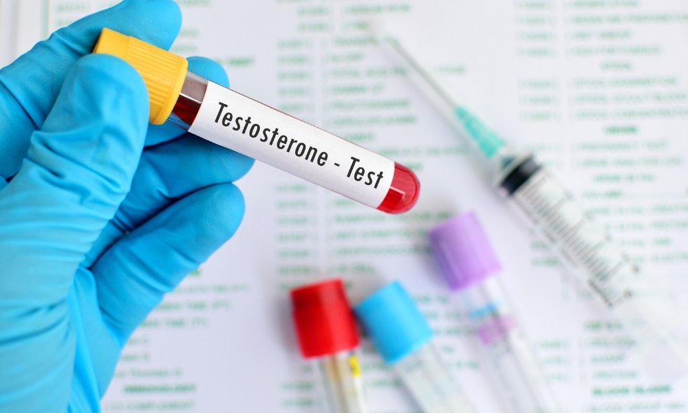 Healthcare provider reviewing testosterone blood test results with male patient