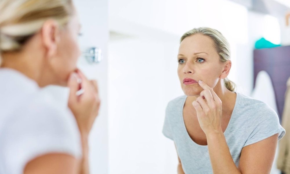Comparison between herpes blister and pimple on the lip